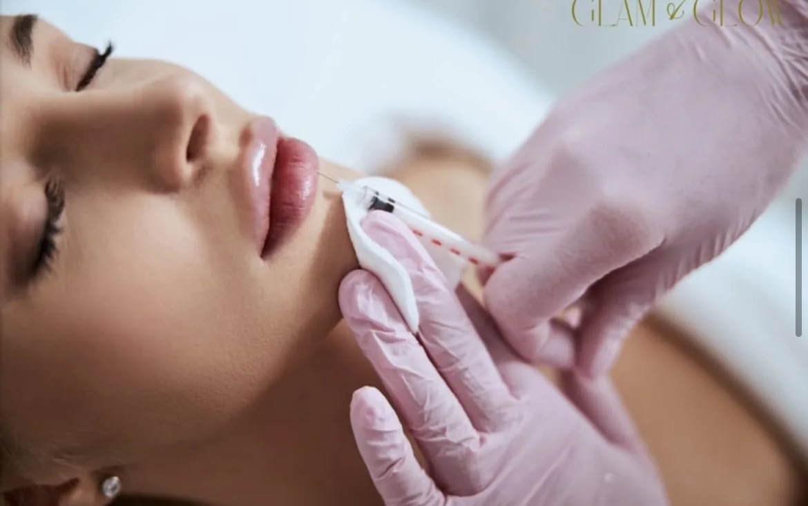 Lip filler aesthetic injectable treatment